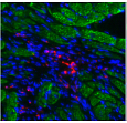 Стволовые клетки сердца (розовые) в окружение кардиомиоцитов (зелёные) // Источник: Павел Макаревич