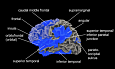 Левое полушарие головного мозга. Синим цветом обозначены области, где была обнаружена гипогирификация у пациентов с шизофренией по сравнению с контрольной группой (по данным проведенного исследования)