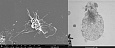 Слева — обычный активированный тромбоцит (фото со сканирующего электронного микроскопа), справа — сверхактивированный тромбоцит (фото с просвечивающего электронного микроскопа). Источник: Михаил Пантелеев