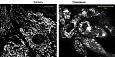 Фрагментация митохондриального ретикулума после гипоксии/реоксигенации клеток эпителия канальцев 