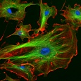 Цитоскелет клетки – микрофиламенты показаны красным цветом, микротрубочки – зеленым, клеточные ядра – голубым. Источник:  ImageJ-Programmpaket.