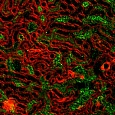Изображение почечной ткани, полученное на лазерном конфокальном сканирующем микроскопе. Окраска на цитоскелет (красная флуоресценция) и ацетилированные белки (зеленая флуоресценция). Источник: Егор Плотников