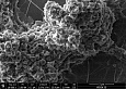 Микрофотография тромба, полученная с помощью сканирующего электронного микроскопа