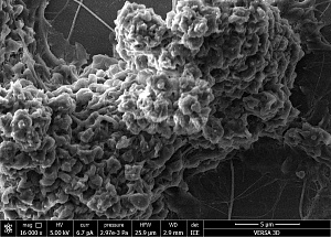 Микрофотография тромба, полученная с помощью сканирующего электронного микроскопа